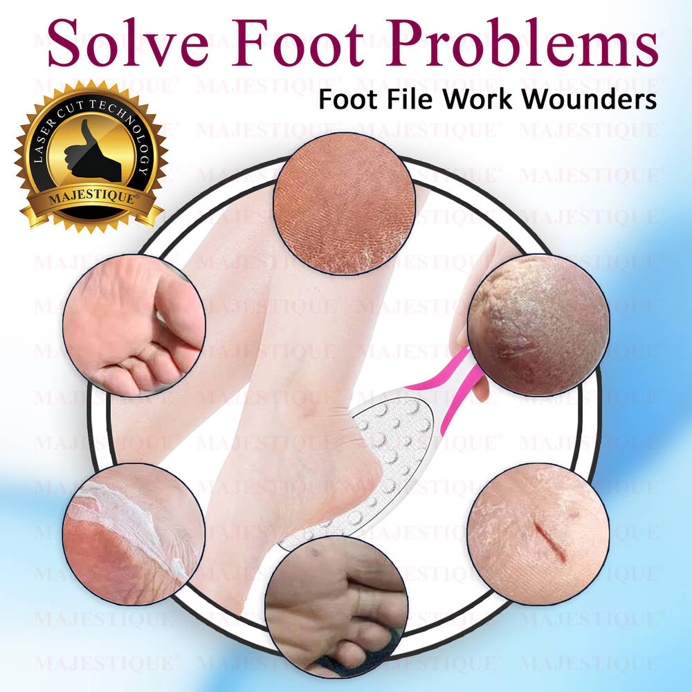 Image 7 of Majestique Foot File with Handle - Professional Pedicure for Callus Removal - Color May Vary