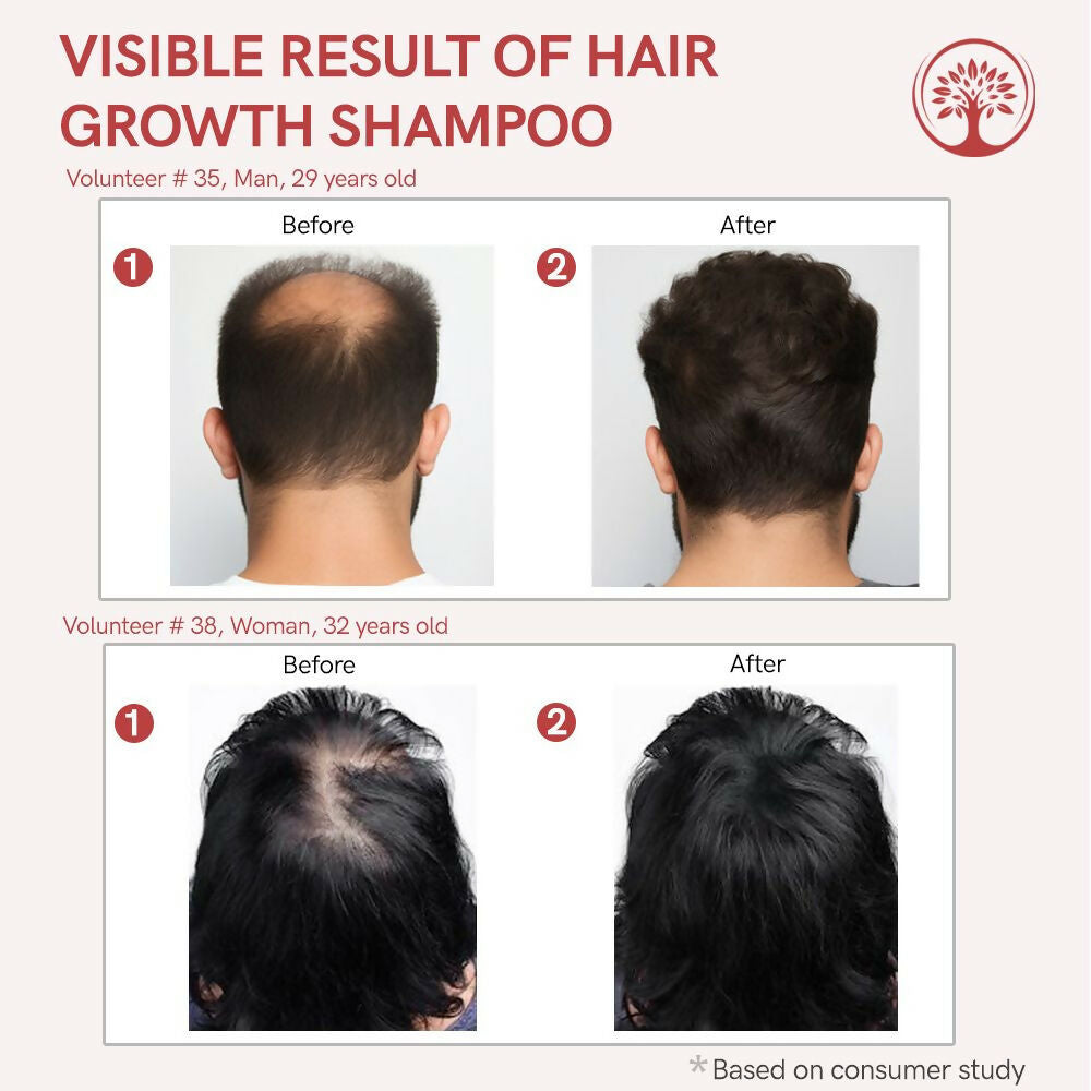 https://cdn.shopify.com/s/files/1/1857/6931/files/YEWiVBVEOt.jpg?v=1717584855