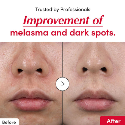 https://cdn.shopify.com/s/files/1/1857/6931/files/024e6c5EQQUA00000003_5.jpg?v=1777271417