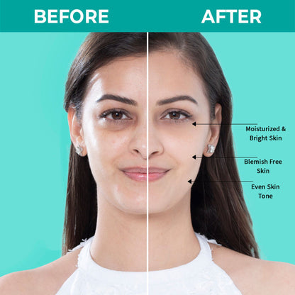 Image 10 of Nykaa SKINRX Spot Corrector with 10% Niacinamide + 1% Zinc Serum to Fade Dark Spots & Pigmentation