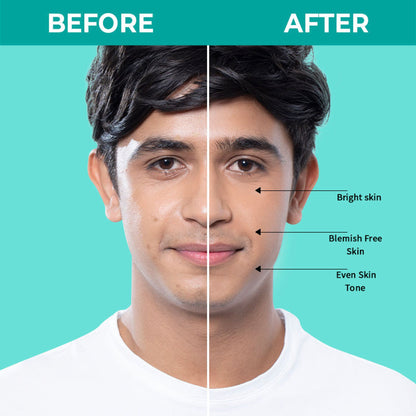 Image 11 of Nykaa SKINRX Spot Corrector with 10% Niacinamide + 1% Zinc Serum to Fade Dark Spots & Pigmentation