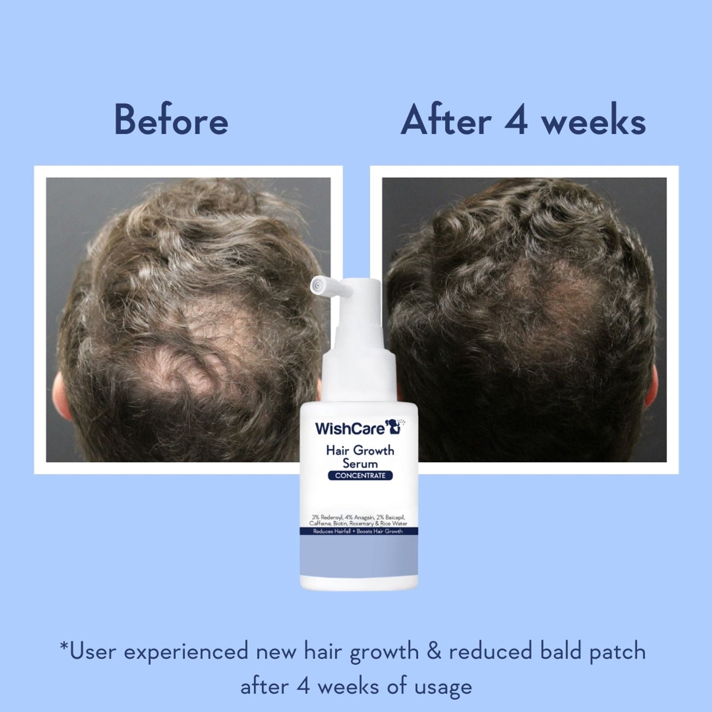 https://cdn.shopify.com/s/files/1/1857/6931/files/11e64faWISHC00000135_6.jpg?v=1779951718
