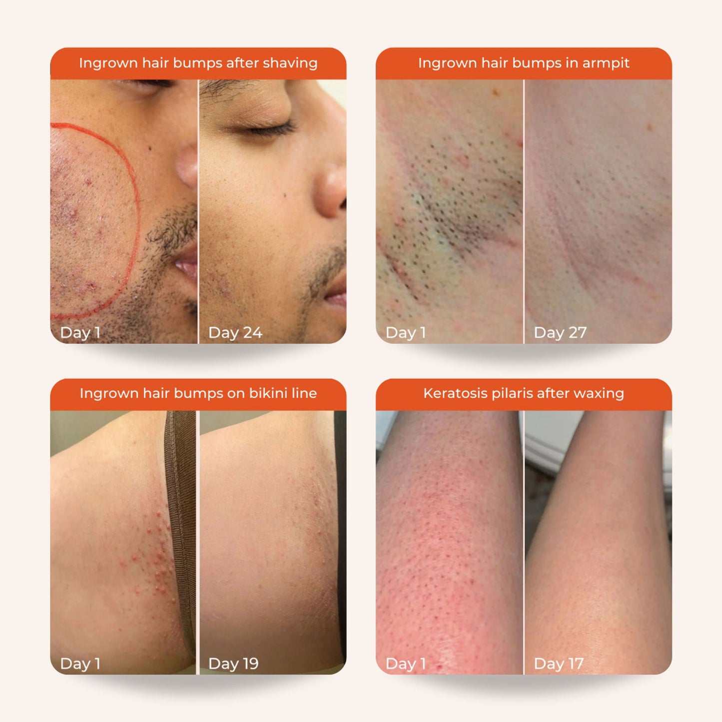 https://cdn.shopify.com/s/files/1/1857/6931/files/138925cSKINV00000016_7.jpg?v=1776669224