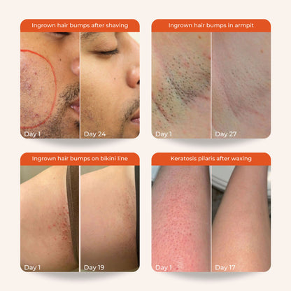 https://cdn.shopify.com/s/files/1/1857/6931/files/138925cSKINV00000016_7.jpg?v=1776669224