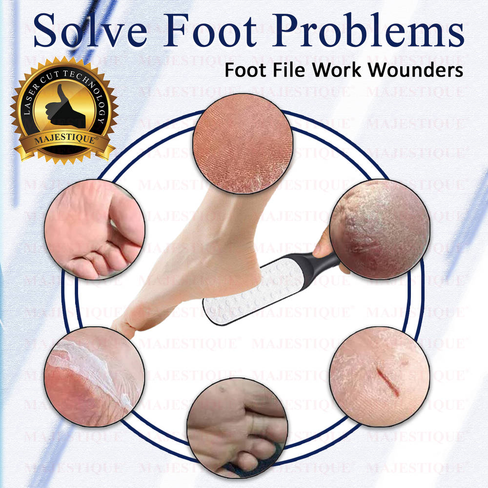 Image 7 of Majestique Callus Remover Foot Scrubber for Pedicure Spa Treatment - Color May Vary
