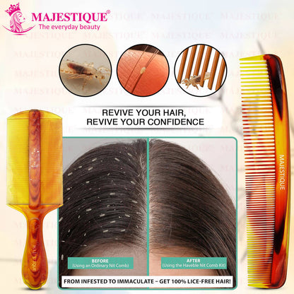 Image 4 of Majestique Hair Grooming & Lice Comb Set - Multicolour