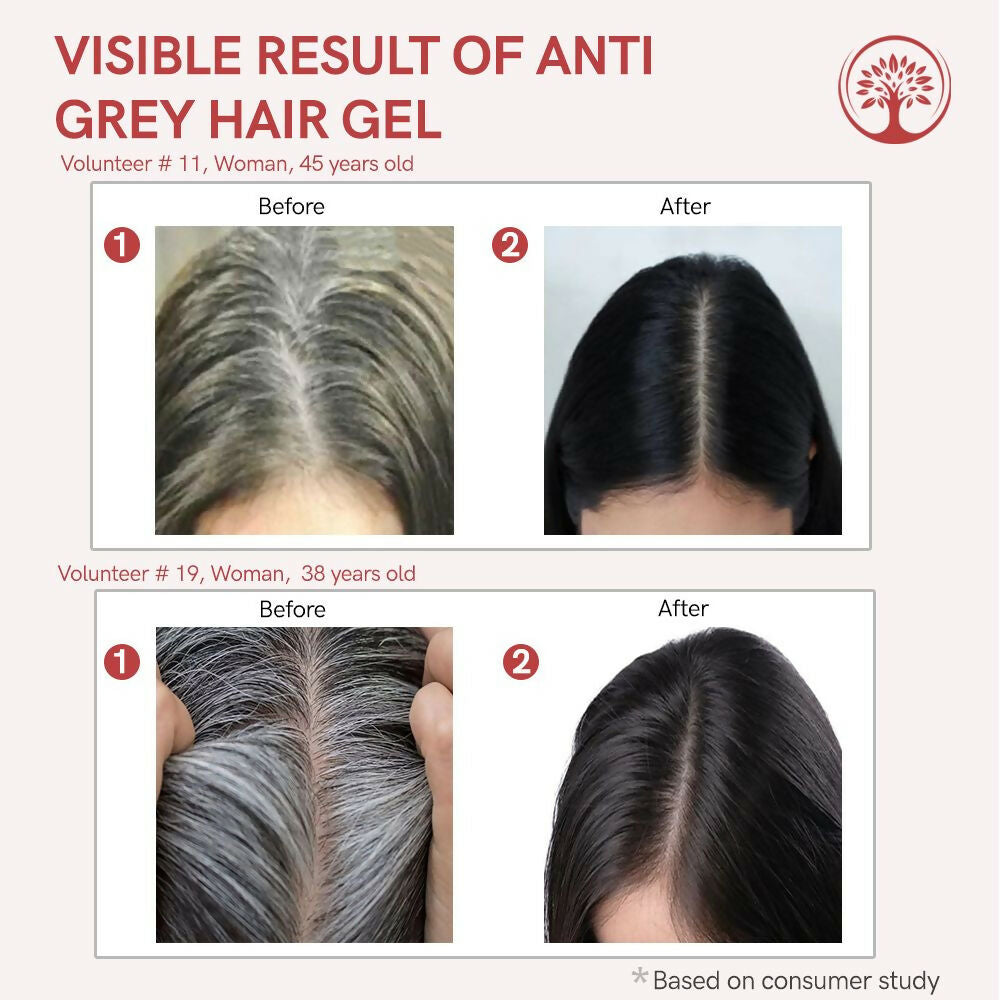 https://cdn.shopify.com/s/files/1/1857/6931/files/4jTVY8arR6.jpg?v=1755924345