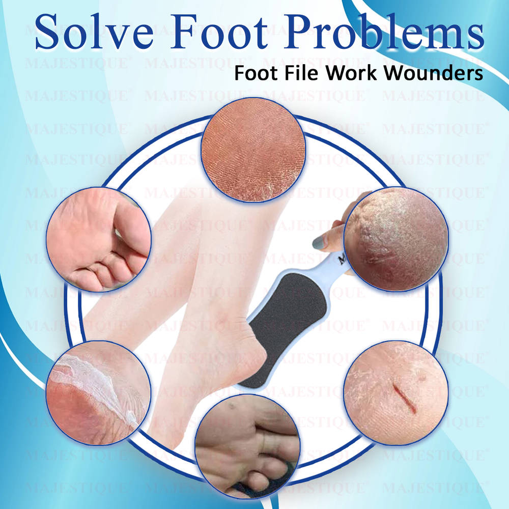 Image 7 of Majestique Foot Scrubber - Callus Remover & Pedicure Tool for Wet & Dry Feet - Color May Vary