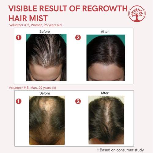 Image 3 of Ivory Natural Regrowth Hair Mist, Boost Hair Growth, Strengthen Follicles, and Restore Shine
