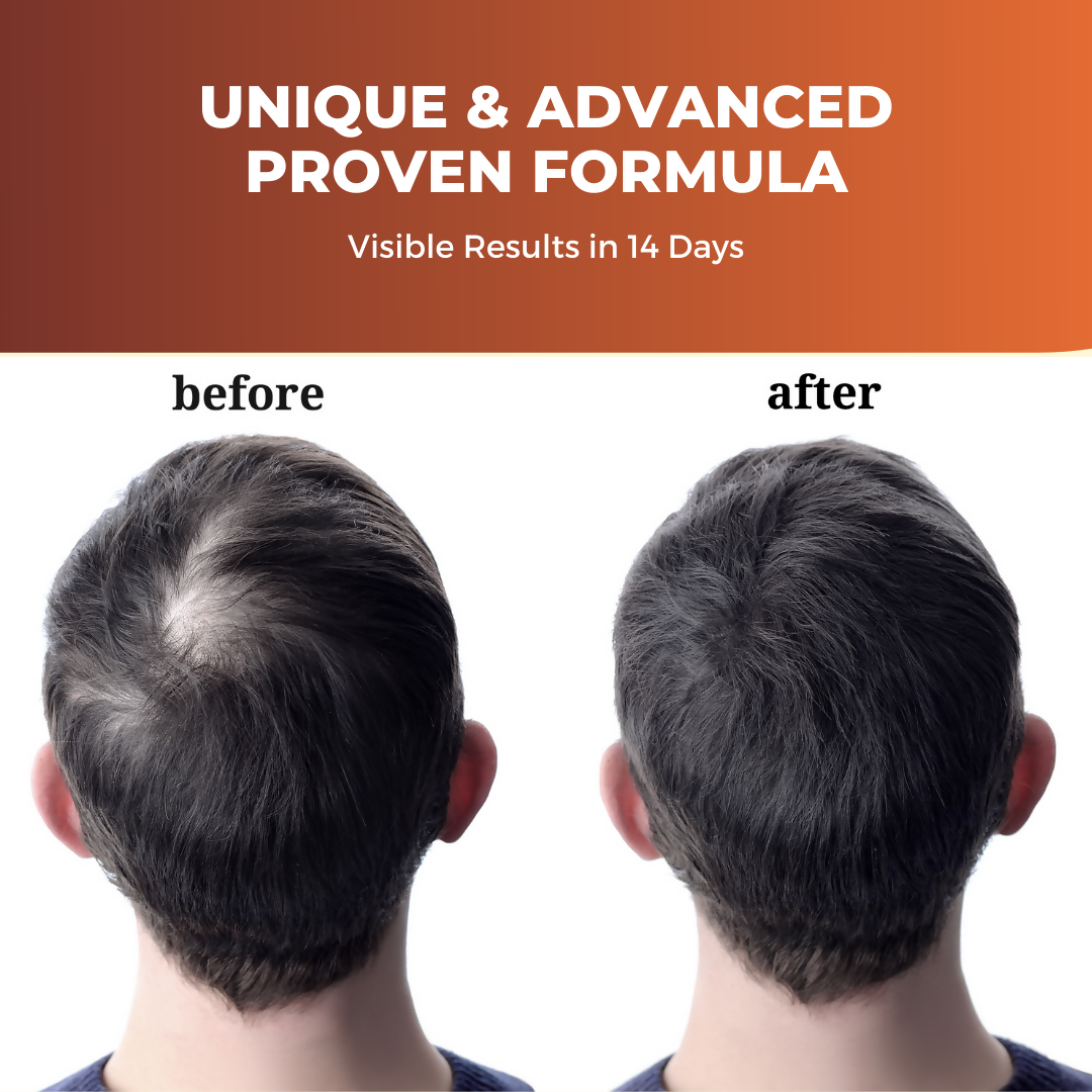 https://cdn.shopify.com/s/files/1/1857/6931/products/5AV5p0QI4f.png?v=1691659711