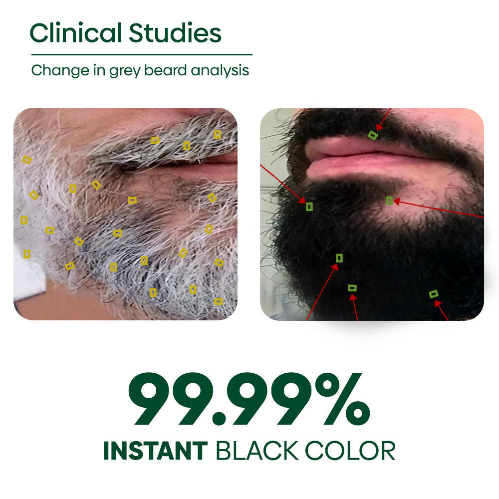 https://cdn.shopify.com/s/files/1/1857/6931/files/5h9idkq6Za.jpg?v=1749464350