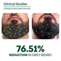 https://cdn.shopify.com/s/files/1/1857/6931/files/6VWZJV5yPG.jpg?v=1749451760