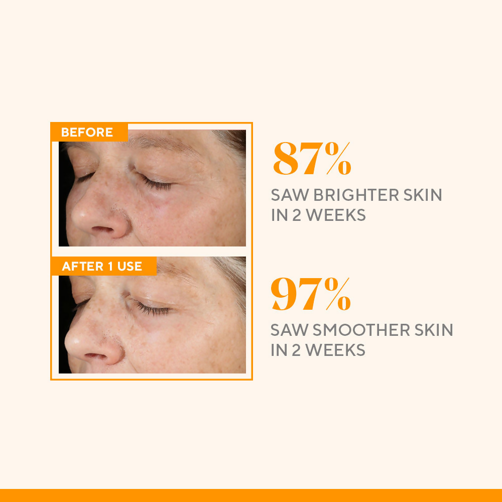 https://cdn.shopify.com/s/files/1/1857/6931/files/7zaTJlEUy7.png?v=1720602869