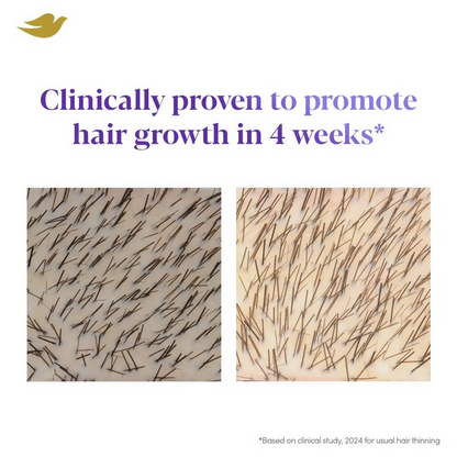 Image 4 of Dove Scalp + Hair Therapy Density Boost Revitalizing Scalp Night Serum