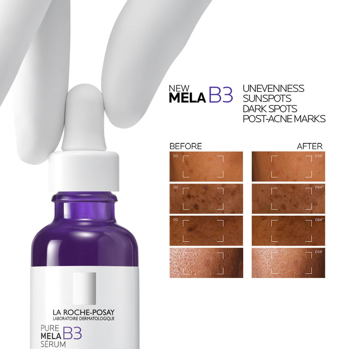 Image 4 of La Roche-Posay Mela B3 Serum, For Anti-Dark Spots & Pigmented Skin with Melasyl + 10% Niacinamide