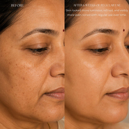 Image 6 of Velleja Kumkumadi Face Oil with Kashmiri Saffron & Sandalwood | Ayurvedic Anti Aging Face Serum for Brightening, Dark Spots & Pigmentation