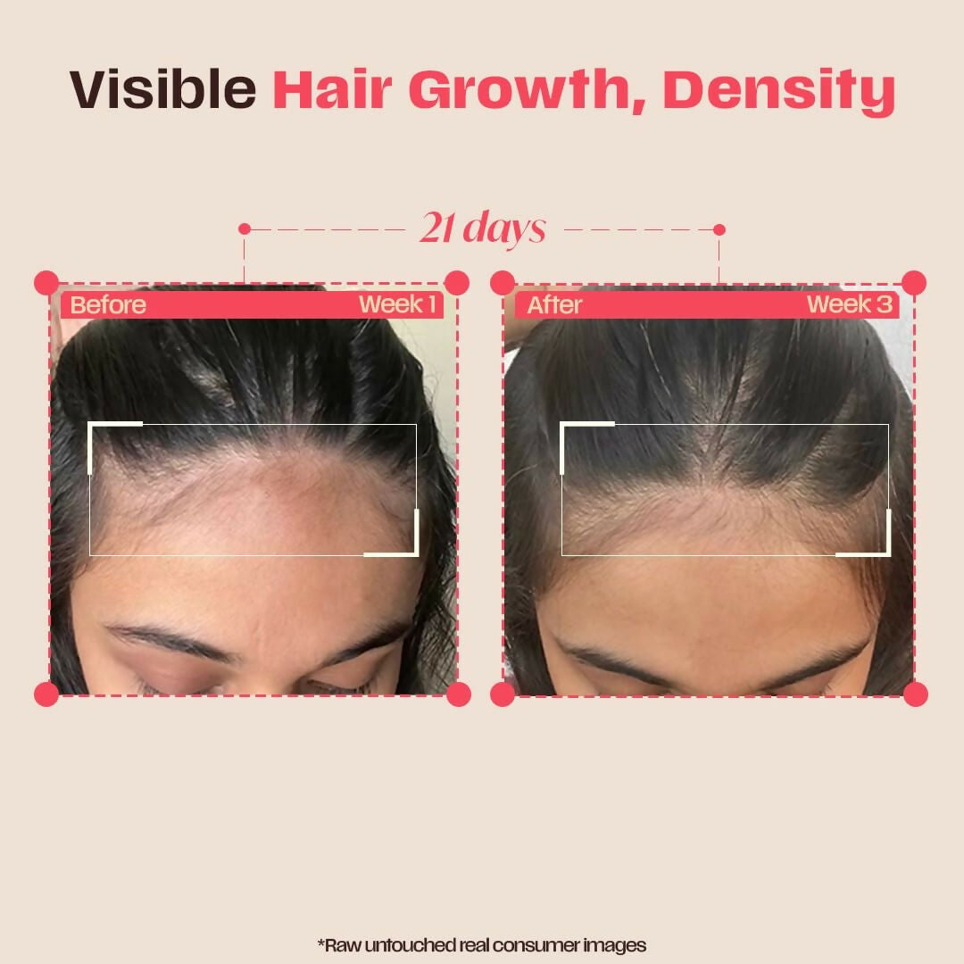 https://cdn.shopify.com/s/files/1/1857/6931/files/ACkKPNhFQD.jpg?v=1779690763