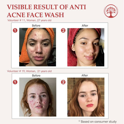 https://cdn.shopify.com/s/files/1/1857/6931/files/AcbmCX7jty.jpg?v=1717594346
