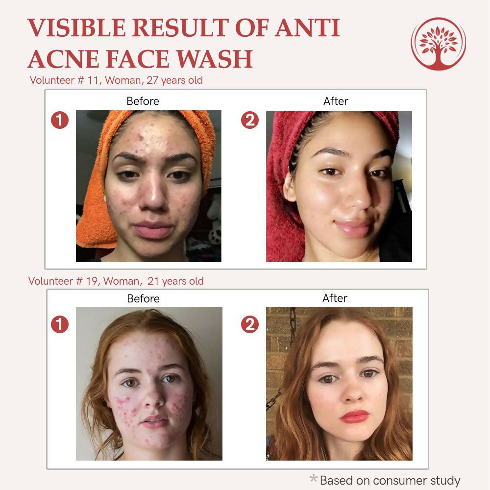 https://cdn.shopify.com/s/files/1/1857/6931/files/AcbmCX7jty.jpg?v=1717594346