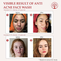 https://cdn.shopify.com/s/files/1/1857/6931/files/AcbmCX7jty.jpg?v=1717594346