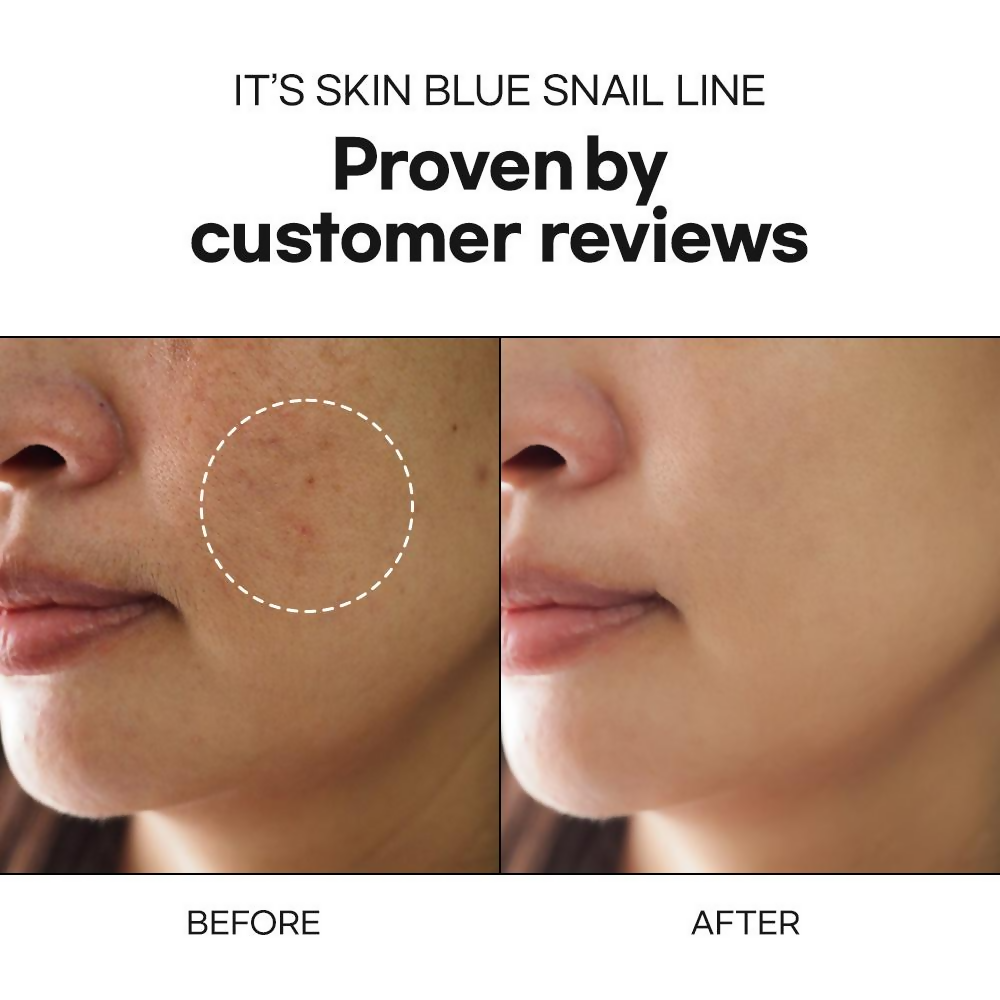 https://cdn.shopify.com/s/files/1/1857/6931/files/AxIDdZA1AX.png?v=1740488878