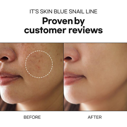 https://cdn.shopify.com/s/files/1/1857/6931/files/AxIDdZA1AX.png?v=1740488878