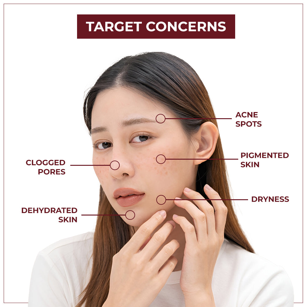 https://cdn.shopify.com/s/files/1/1857/6931/files/Depigmentation_Gel_-_Target_Concerns.jpg?v=1778491913