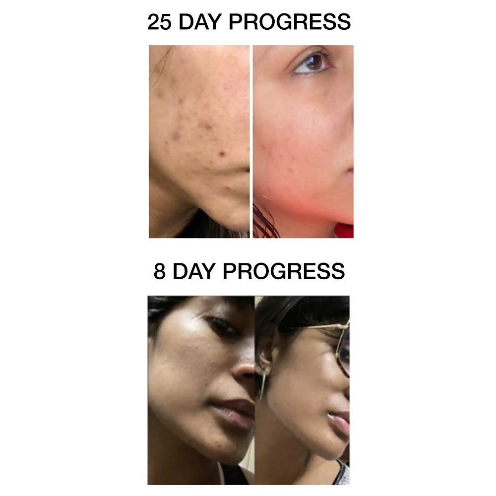 https://cdn.shopify.com/s/files/1/1857/6931/files/FOkPRHALKl.jpg?v=1760089757