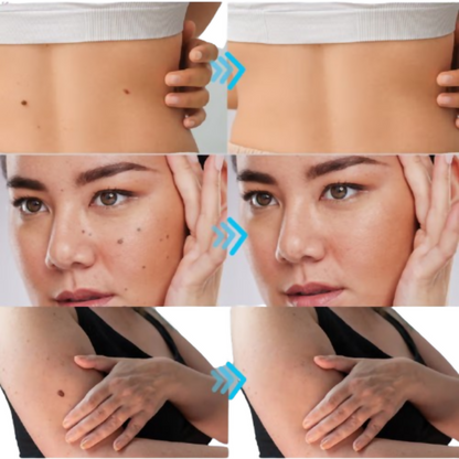 https://cdn.shopify.com/s/files/1/1857/6931/files/GELHemR0Eq.png?v=1777533401