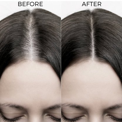 Image 8 of Brillare Onion & Bakuchiol Oil Shots For Hair Fall Reduction