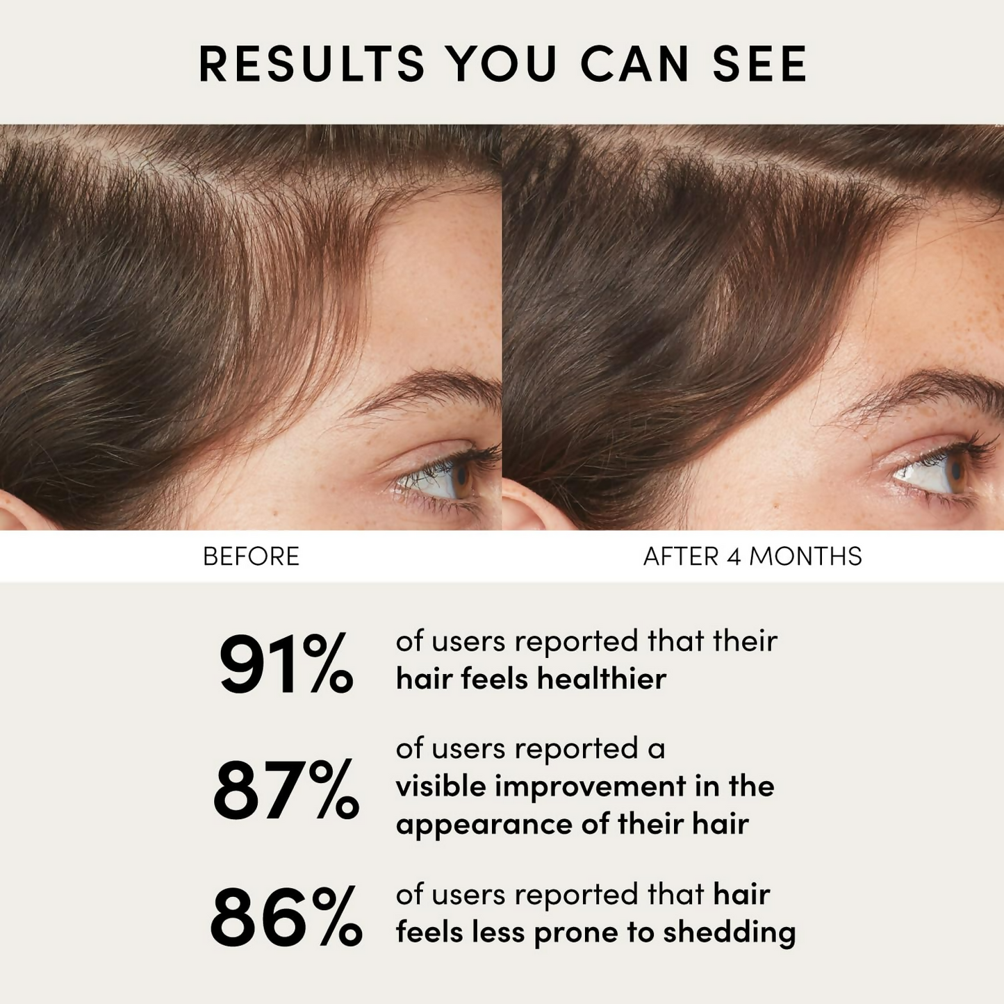 https://cdn.shopify.com/s/files/1/1857/6931/files/H5fH5mSkUd.png?v=1737376023