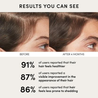 https://cdn.shopify.com/s/files/1/1857/6931/files/H5fH5mSkUd.png?v=1737376023
