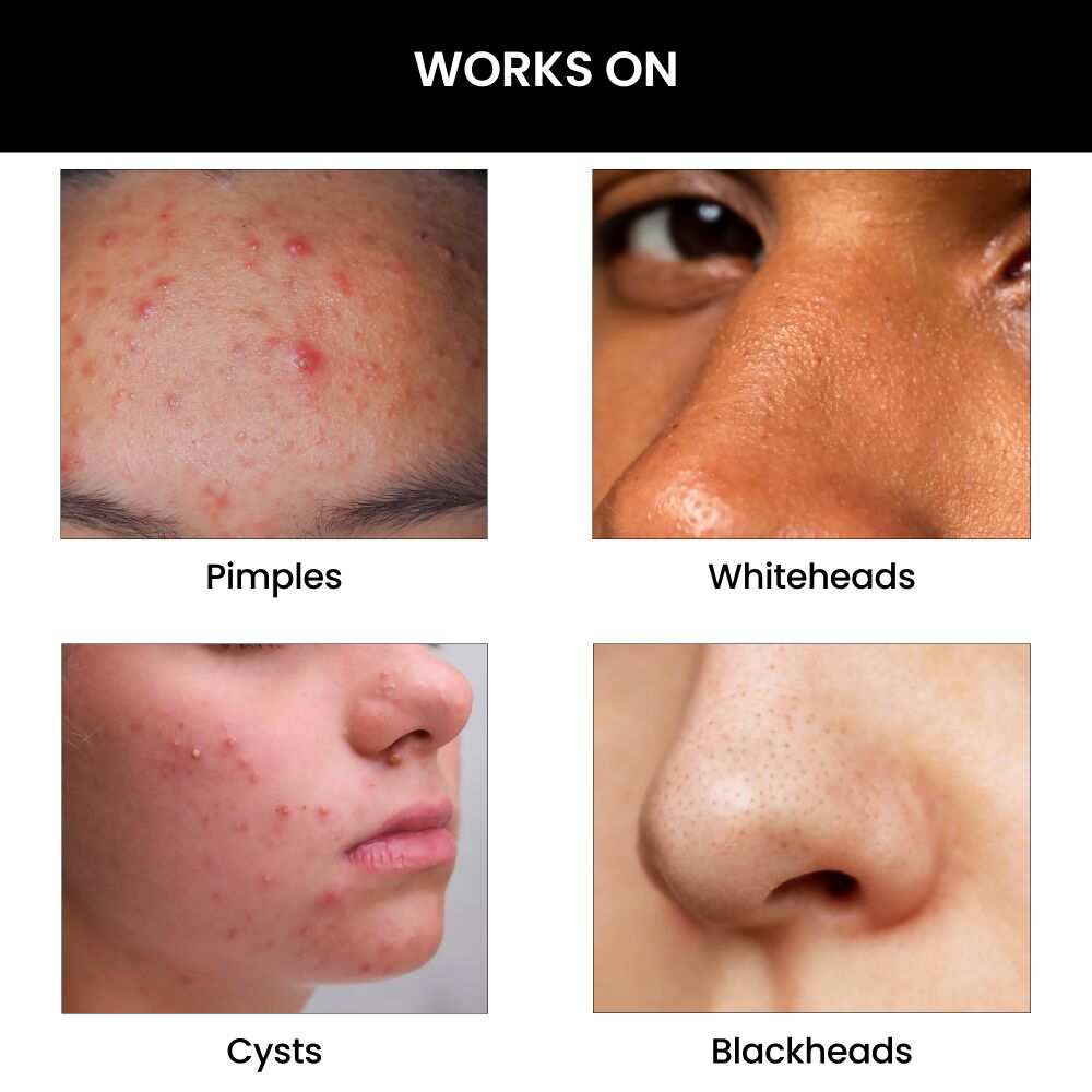 https://cdn.shopify.com/s/files/1/1857/6931/files/HXCn1JB9n7.jpg?v=1713851355
