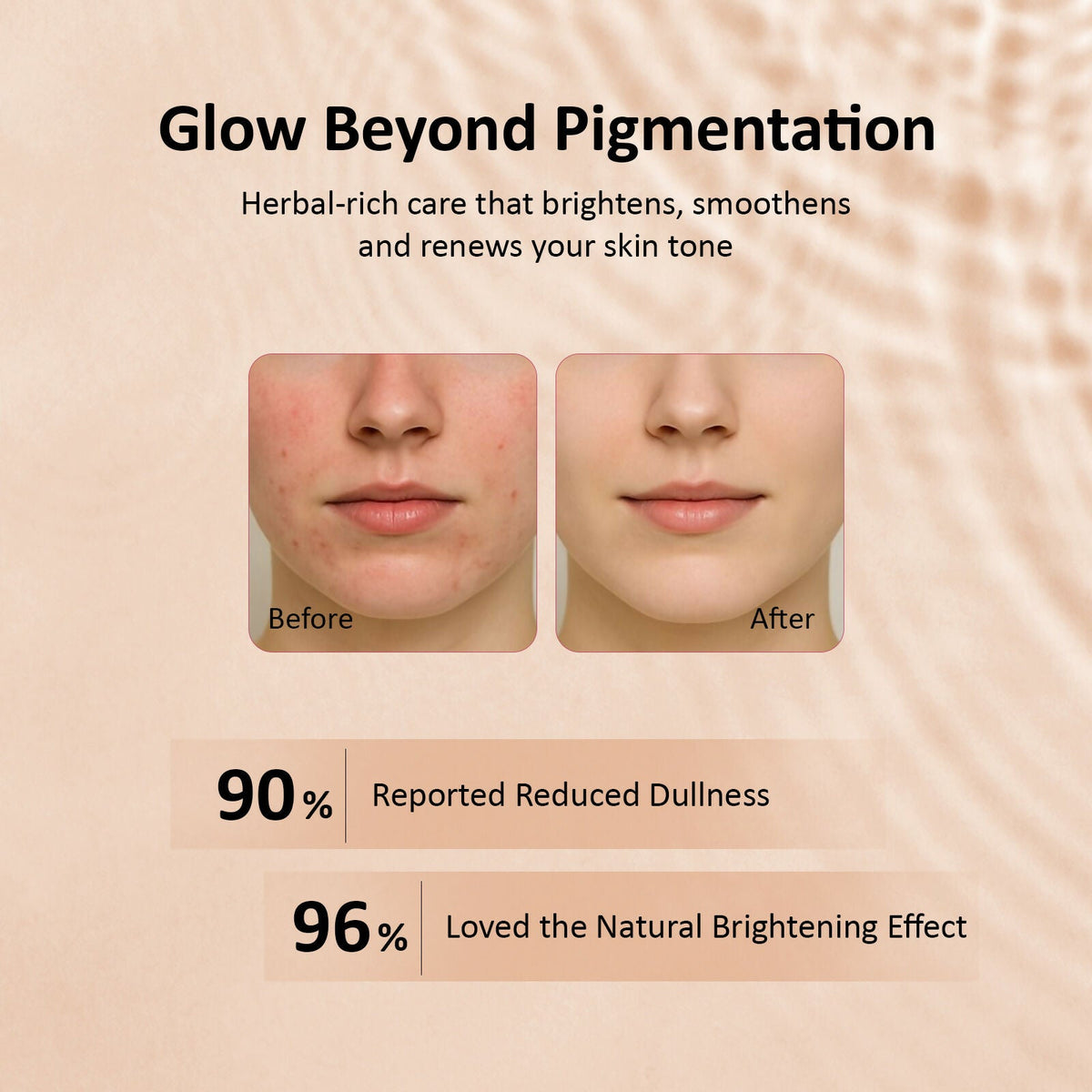 Image 6 of CareVeda Tone & Glow Anti Pigmentation Sheet Mask Suitable For All Skin Types