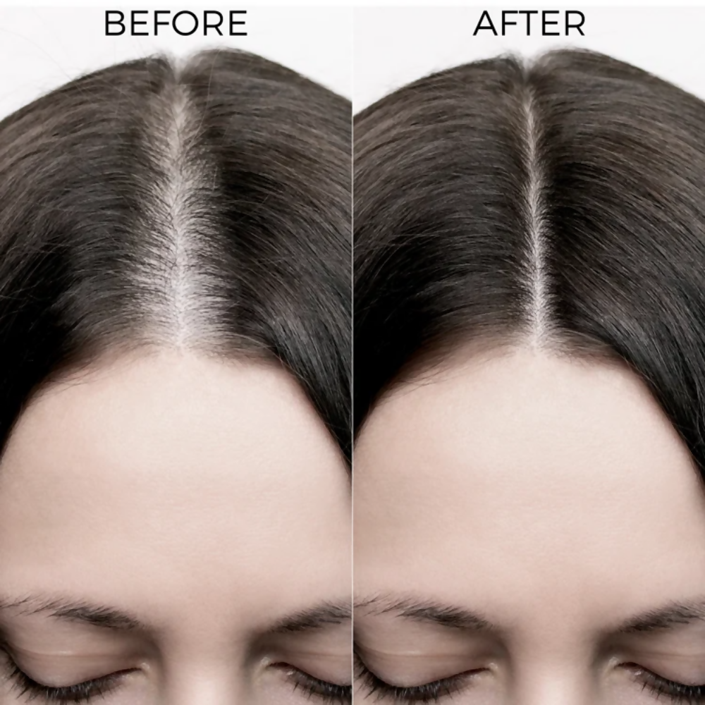 Image 4 of Brillare Rosemary Oil Shots For Visible Hair Growth
