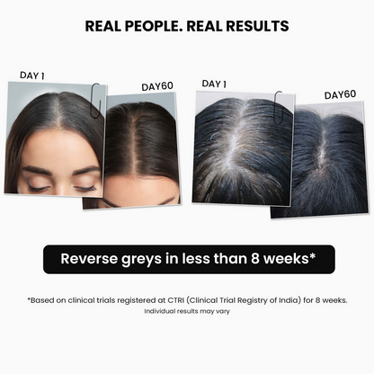 https://cdn.shopify.com/s/files/1/1857/6931/files/IU352iF7DE.png?v=1741693456