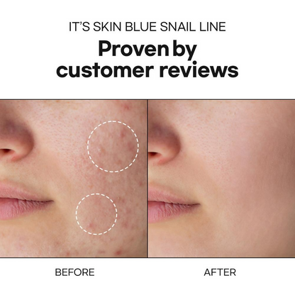 https://cdn.shopify.com/s/files/1/1857/6931/files/IceZVOgt3l.png?v=1740488998
