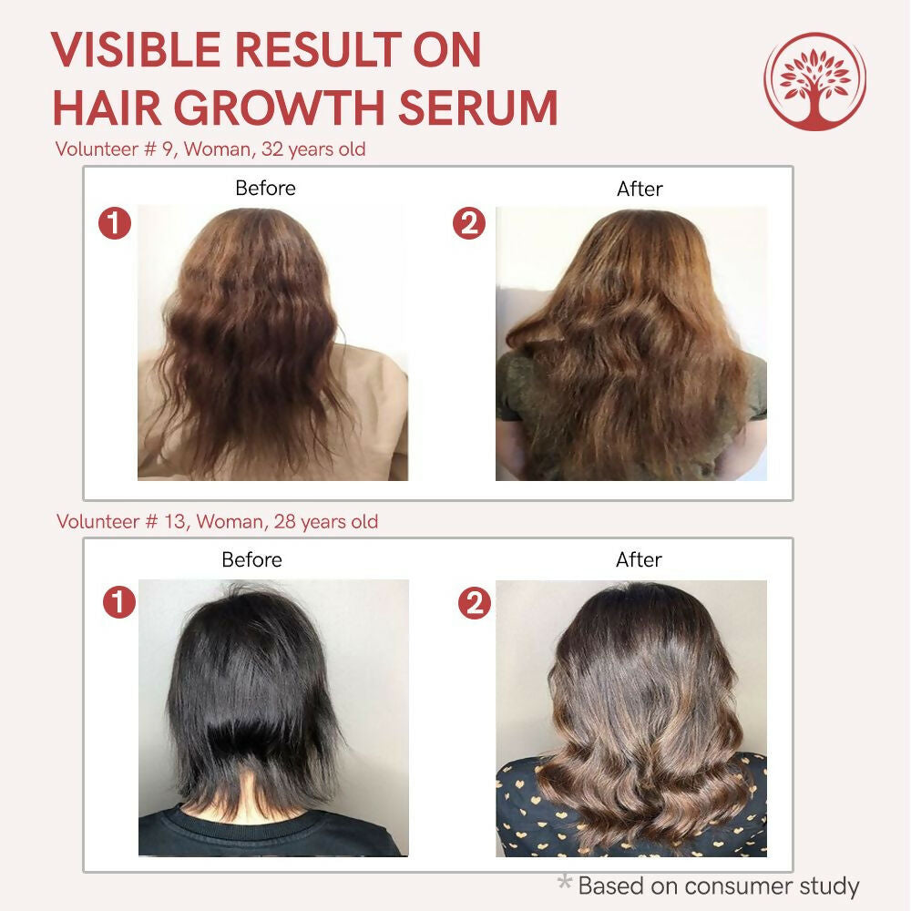 https://cdn.shopify.com/s/files/1/1857/6931/files/KQAVvPnhVt.jpg?v=1717828336