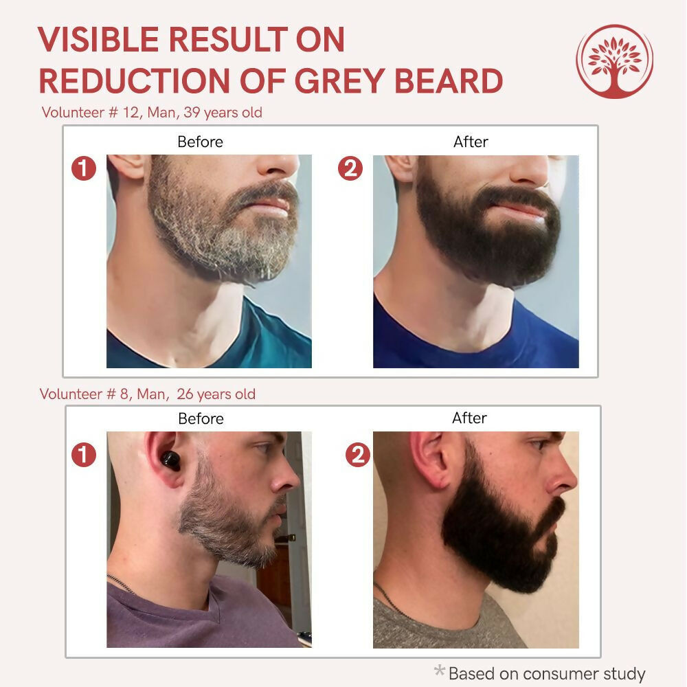 https://cdn.shopify.com/s/files/1/1857/6931/files/L2mDCUZkxG.jpg?v=1755678779