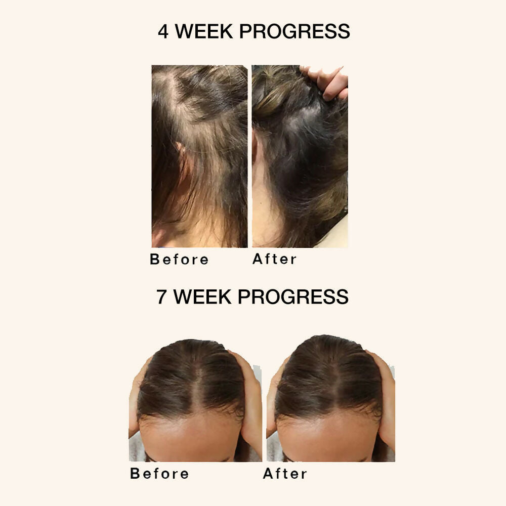 https://cdn.shopify.com/s/files/1/1857/6931/files/McK44UB0dn.jpg?v=1760089758