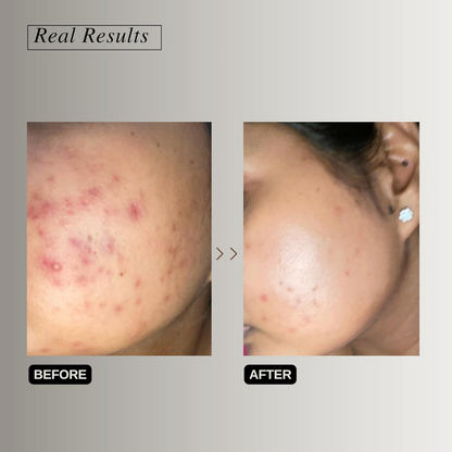 https://cdn.shopify.com/s/files/1/1857/6931/files/NRqmCpTF8p.png?v=1725366139