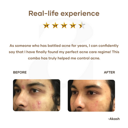 https://cdn.shopify.com/s/files/1/1857/6931/files/Q3RC6dXSNq.png?v=1721384697