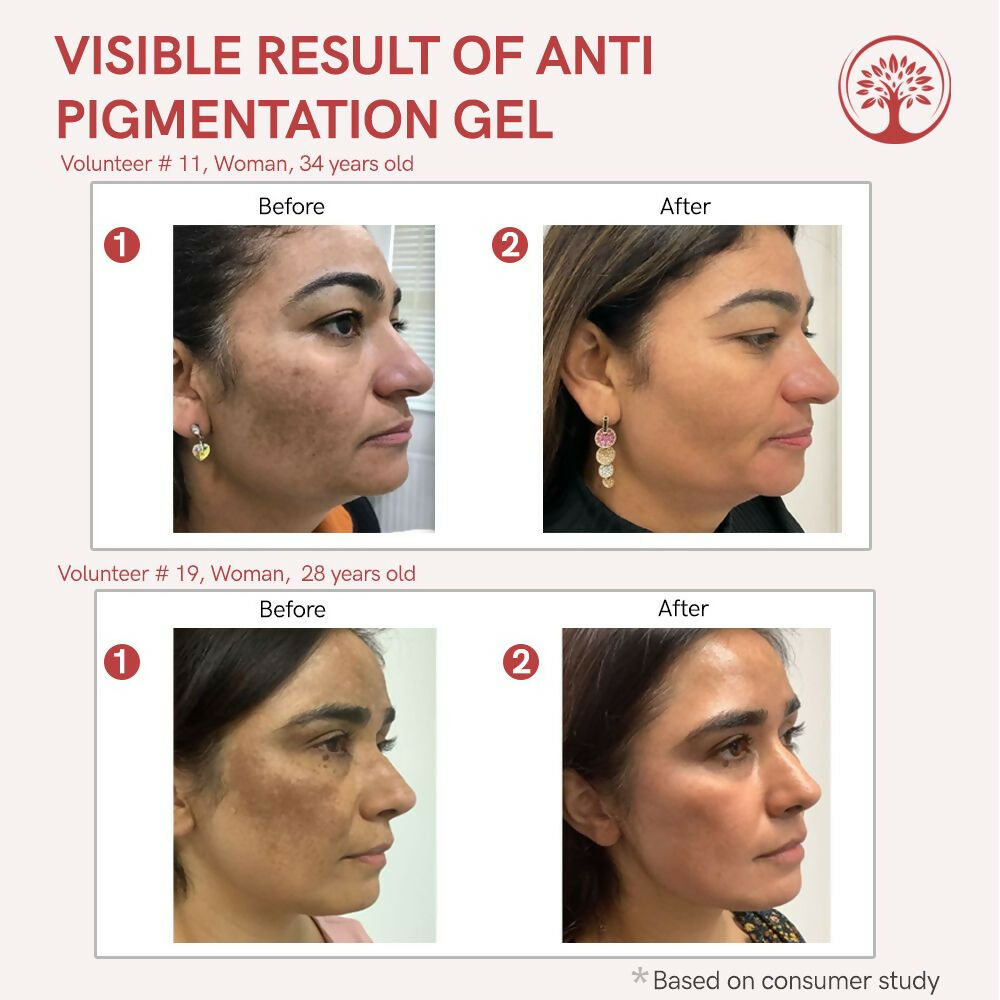 https://cdn.shopify.com/s/files/1/1857/6931/files/QIPDv9UQbt.jpg?v=1717594411
