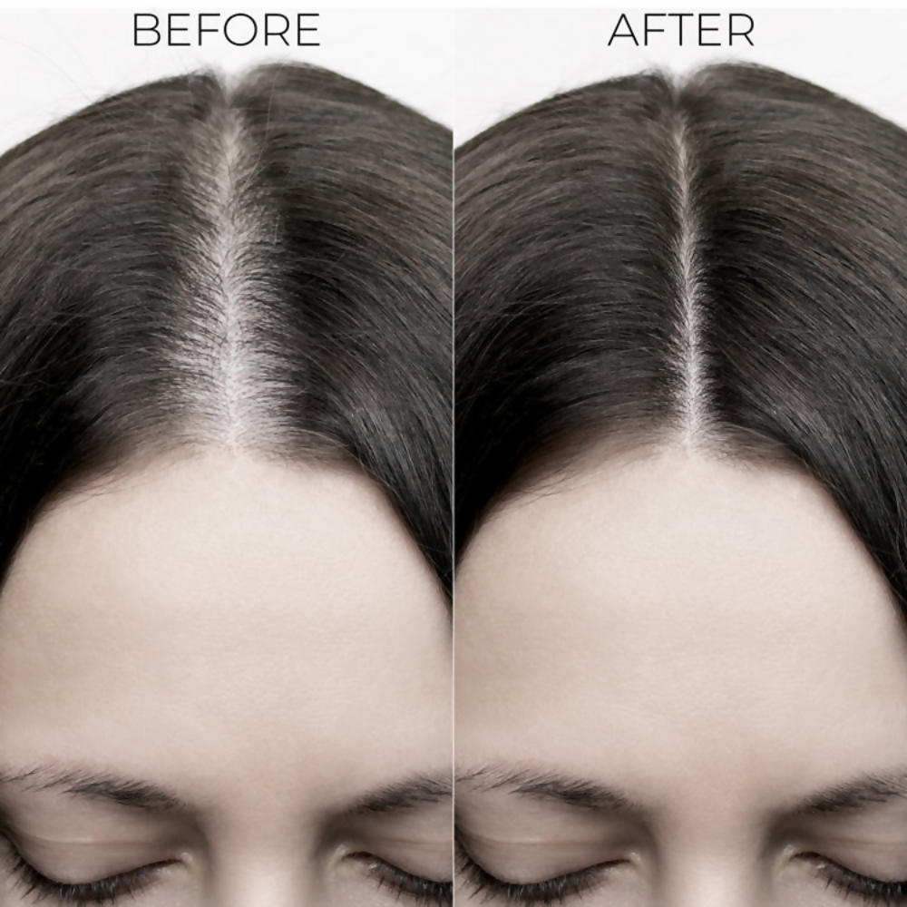 Image 5 of Brillare Hair Fall Control Kit