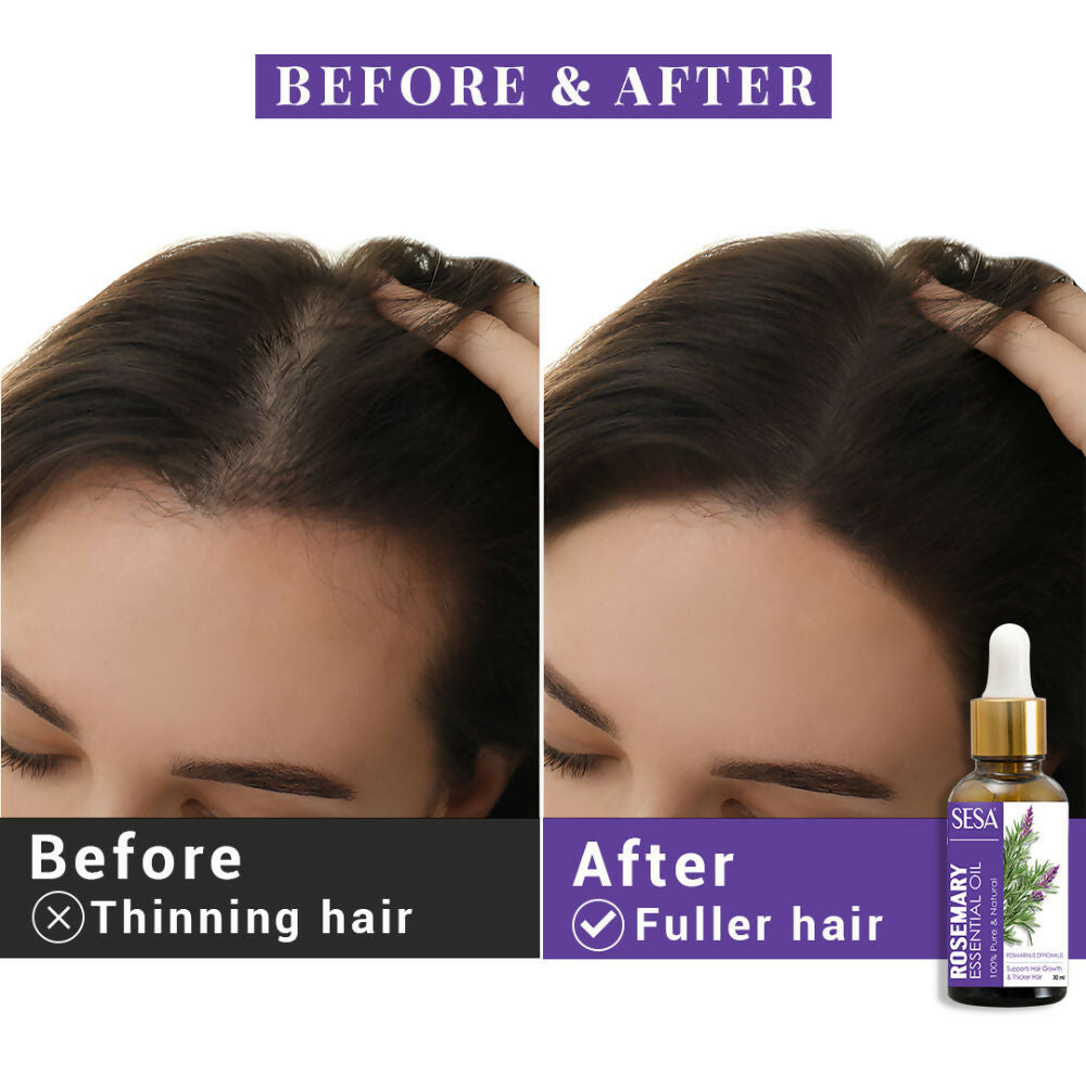 https://cdn.shopify.com/s/files/1/1857/6931/files/SonLR31T56.jpg?v=1741779519