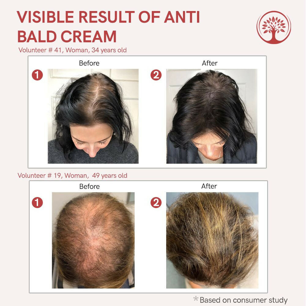 https://cdn.shopify.com/s/files/1/1857/6931/files/Ut5OILnAdB.jpg?v=1717673917