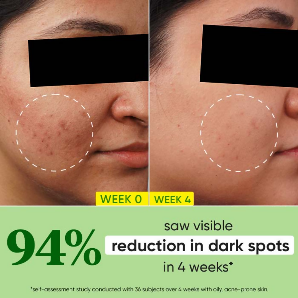 https://cdn.shopify.com/s/files/1/1857/6931/files/WfSd7Qh88h.png?v=1740660418
