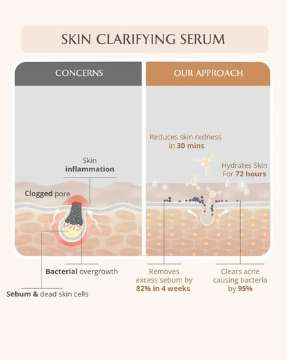 https://cdn.shopify.com/s/files/1/1857/6931/files/acne-care-ritual-812373.webp?v=1773221195