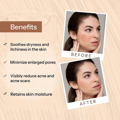 https://cdn.shopify.com/s/files/1/1857/6931/files/acne-scars-pits-removal-gel-378236.webp?v=1781082086