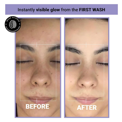 Image 3 of Sereko 50X Vitamin C Face Wash for Glowing & Brightening Skin For Women